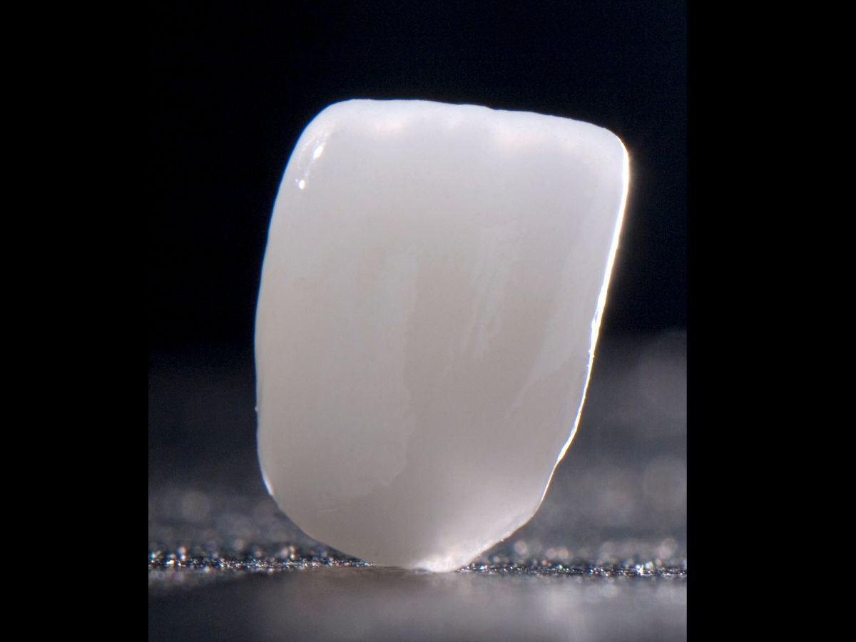 Dental restorations fabricated by Rohling Dental Laboratory